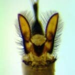 Insect through a microscope